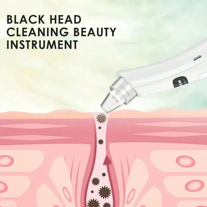 Blackhead Vacuum Remover